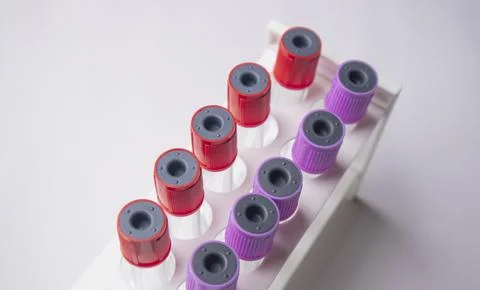 High-angle, overhead shot of multiple medical blood collection tubes with r.. Stock Photos