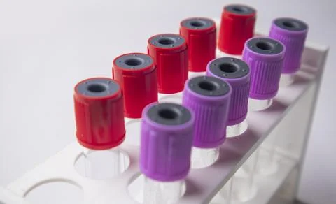 A high-angle, side-view shot of multiple medical blood collection tubes wit.. Stock Photos