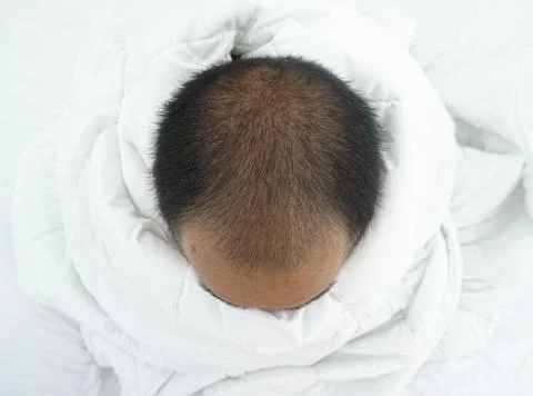 A high angle view of a bald Asian man Sitting and hugging a white blanket on  Stock Photos