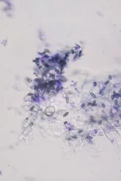 High-Contrast Micrograph of Bipolar, Multi-Septate Fungal Spores Visualizin.. 스톡 사진