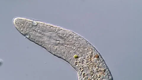 High Definition View of Flatworm in Freshwater Sample, microscope 400x Vidéo 317210642