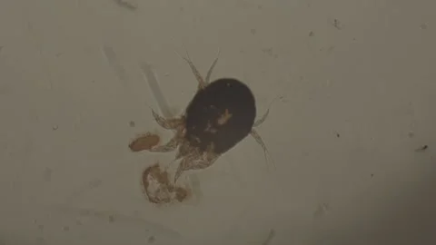 High-Magnification of Bug Under Microscope 100 fps 库存影片 238377034