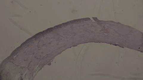High-Magnification of human muscle tissue under microscope 100 fps Stock Footage 238377183