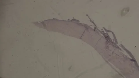 High-Magnification of human sking under microscope 100 fps Stock Footage 238377689