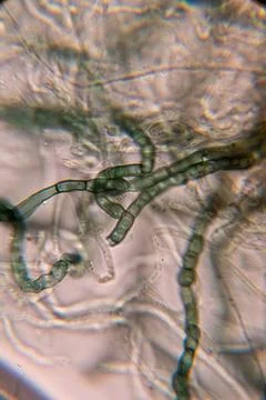 A high-magnification micrograph showing chains of dark, barrel-shaped funga.. 스톡 사진