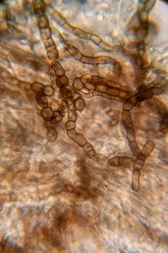 A high-magnification micrograph showing chains of dark, barrel-shaped funga.. 스톡 사진