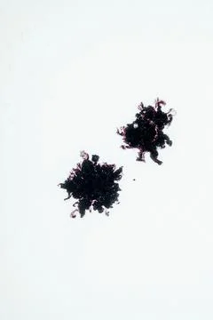 High magnification micrograph showing two dark, clustered fungal spore ball.. Stock Photos