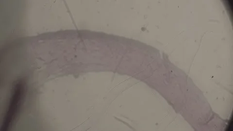High-Magnification of nonpigmented skin Under microscope Super Magnification. Stock Footage 238382199