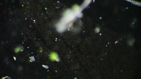 High magnification reveals the dynamic life of bacteria and germs within a .. Video stock 275040726
