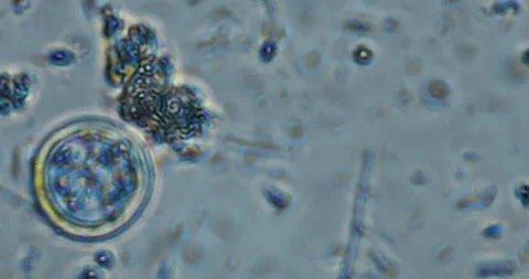 High-magnification video capturing real motion of protozoa, amoeba Stock-Footage 328831563