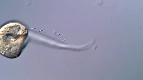 High Magnification Video of Trematode Larvae Vídeos de archivo 317224130