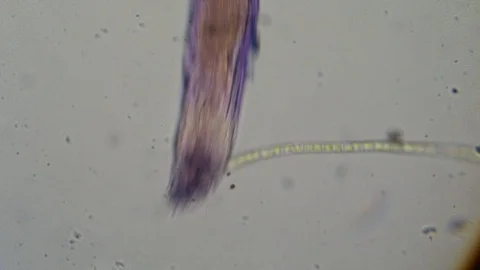 A high power microscopic view of a rotif... | Stock Video | Pond5