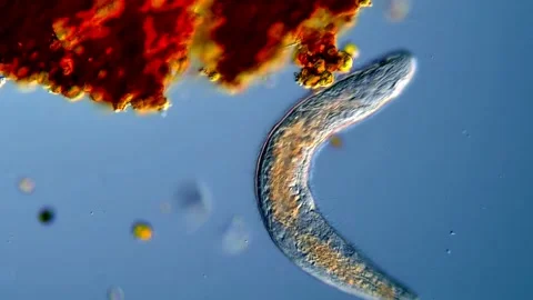 High Quality Flatworm Observation – Microscopic Life 库存影片 317211173