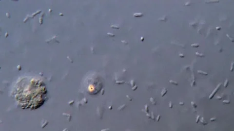 High Resolution Bacteria and parasite Microscope Footage,  1000x 動画素材 317141151