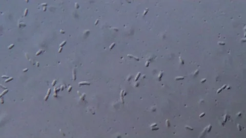 High Resolution Bacteria Microscope Footage, 1000x Vidéo 317141188