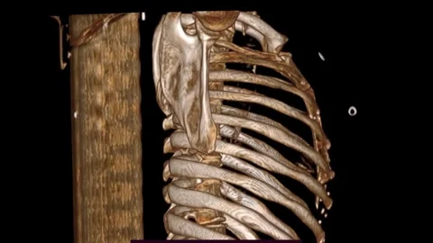 High-Resolution Body CT Scan with Interactive 3D Reconstruction and Detailed Stock Footage 280852748