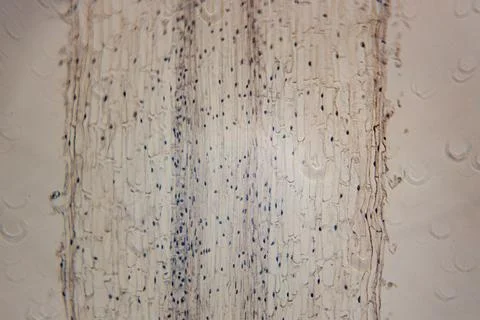 High-resolution micrograph showing the elongation zone. Stock Photos