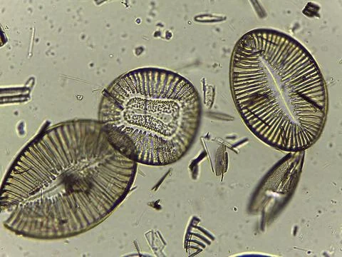 High Resolution Microscopic Study of Ornate Diatom Silica Frustules and Aqu.. Stock Photos