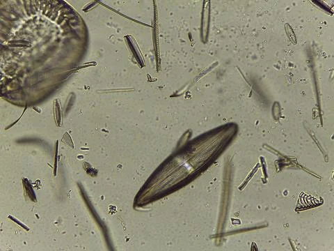 High Resolution Microscopic Study of Ornate Diatom Silica Frustules and Aqu.. Stock Photos