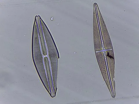 High Resolution Microscopic Study of Ornate Diatom Silica Frustules and Aqu.. Stock Photos