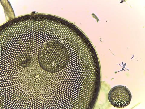 High Resolution Microscopic Study of Ornate Diatom Silica Frustules and Aqu.. 库存照片