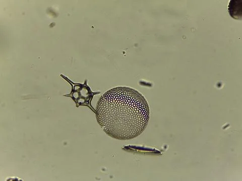 High Resolution Microscopic Study of Ornate Diatom Silica Frustules and Aqu.. 写真素材