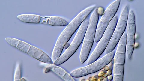 High Resolution Microscopy of Fusarium and mold Spores, 1000x 動画素材 317810590