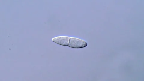 High Resolution Microscopy of Fusarium Spore, 1000x Video stock 317812038