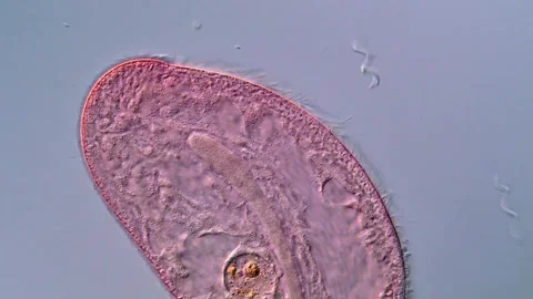 High Resolution video of Blepharisma protozoa under microscopy 库存影片 317633738
