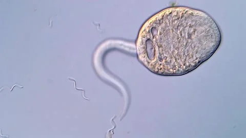 High Resolution View of Cercariae Larvae under Microscope Vídeos de archivo 317226257