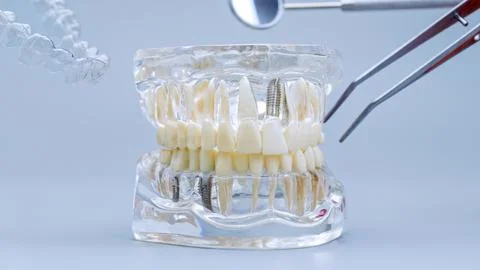 High-tech dentistry concept: Clear anatomical jaw model with floating orthodo Фото