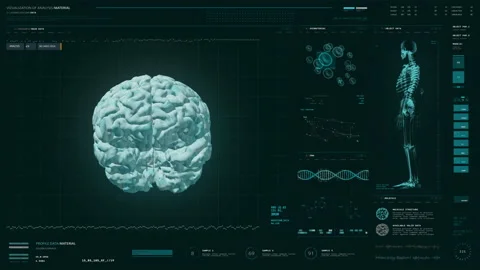 High Tech Diagnostic Interface Conducts Analysis Of Patients Brain Health Stock Footage 168421121