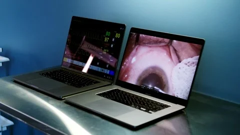 High-tech equipment for ophthalmic surgery close-up Stock Footage 265016716
