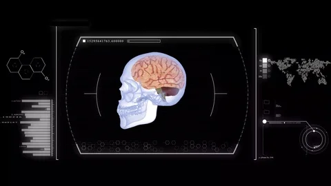 High Tech human brain and skull analysis imaging background 스톡 동영상 113793527
