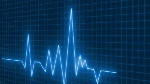 High-Tech Neon Pulse Line Animated Heartbeat ECG, Animated Glowing Heart Ra.. Stock Footage 315004525