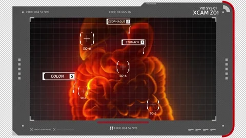 High-tech screen displays an x-ray image of the digestive system. Stock Footage 144827158