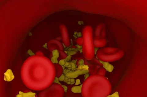 Higher level of cholesterol crystals and red blood cells flowing in artery Illustrazione stock