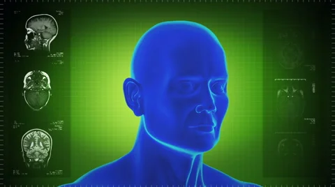 Highly detailed head scan. Loopable. Green background. Stock Footage 59582967