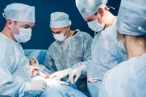 A highly qualified team of surgeons performs a complex operation to remove .. Stock Photos