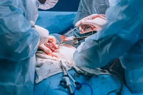 A highly qualified team of surgeons performs a complex operation to remove .. Stock Photos