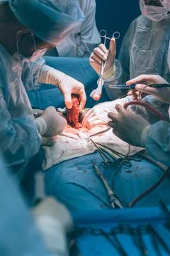 A highly qualified team of surgeons performs a complex operation to remove .. Stock Photos