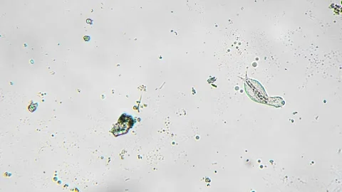 Highresolution imaging reveals diverse diatom forms and algae cells for Stock Footage 344086815
