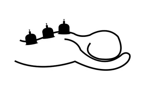 Hijama cupping technique Stock Illustration