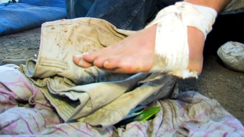 Hiker with sprained ankle Stock Footage 89480806