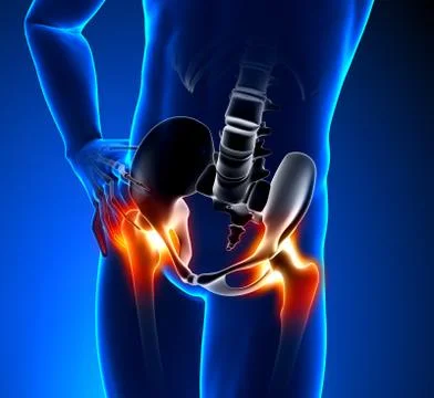Hip Bone - Pain in Hip Bone - Hurt Hip Bone Stock-Illustration