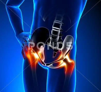 Hip Bone - Pain in Hip Bone - Hurt Hip Bone Stock Photos