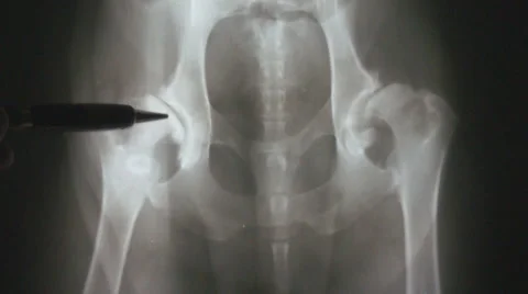 Hip Dysplasia Dog Stock Footage 5184889