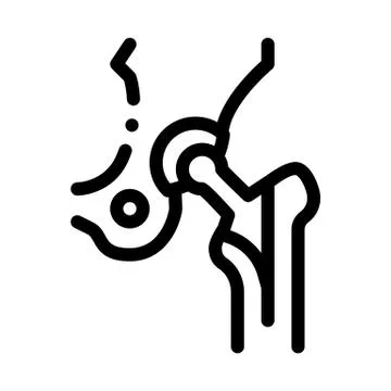 Hip Implant Replacement Biomaterial Vector Icon Stock Illustration