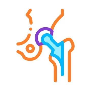 Hip Implant Replacement Biomaterial Vector Icon Stock Illustration