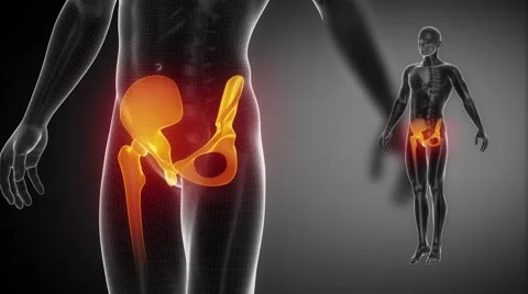 HIP joint bone skeleton x-ray scan in black Vidéo 48061954